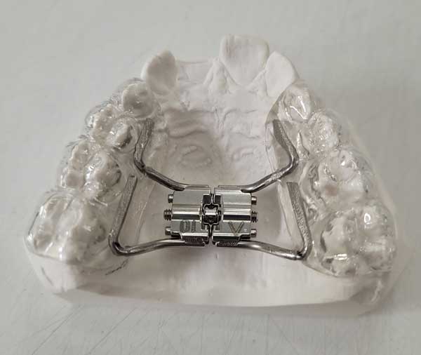 Visuel-orthodontie---2
