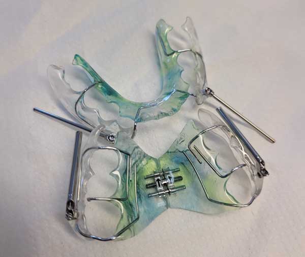 Visuel-orthodontie---3